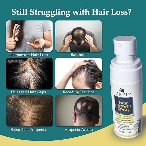 Natural Hair Growth Oil Spray Batana Rosemary Serum Biotin Caffeine Scalp Car...